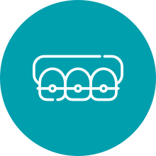 Dental Braces